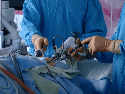 Kirurška intervencija